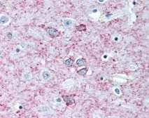 Anti-Adenosine A2a Receptor antibody [7F6-G5-A2] used in IHC (Paraffin sections) (IHC-P). GTX04561