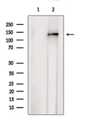 Anti-AHI1 antibody used in Western Blot (WB). GTX04581