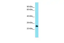 Anti-CHMP4C antibody used in Western Blot (WB). GTX04627