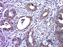 Anti-Human Papillomavirus type 16 E6 antibody used in IHC (Paraffin sections) (IHC-P). GTX04630