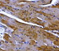 Anti-NDUFS2 antibody used in IHC (Paraffin sections) (IHC-P). GTX04733