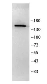 Anti-YSK4 antibody used in Western Blot (WB). GTX04734