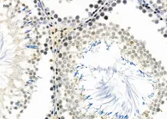 Anti-DCP1A antibody used in IHC (Paraffin sections) (IHC-P). GTX04801