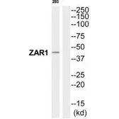 Anti-ZAR1 antibody used in Western Blot (WB). GTX04804