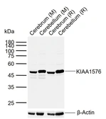 Anti-VAT1L antibody used in Western Blot (WB). GTX04840