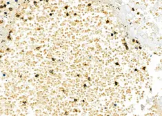 Anti-TIM-3 antibody used in IHC (Paraffin sections) (IHC-P). GTX04872
