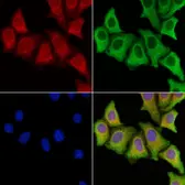Anti-CTGF antibody used in Immunocytochemistry/ Immunofluorescence (ICC/IF). GTX04889