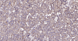 Anti-Amphiregulin antibody used in IHC (Paraffin sections) (IHC-P). GTX04890