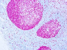 Anti-Ki67 antibody [SP6] (ready-to-use) used in IHC (Paraffin sections) (IHC-P). GTX04940