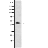Anti-LHX3 antibody used in Western Blot (WB). GTX04985