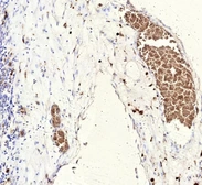 Anti-FLI1 antibody [rFLI1/9614] used in IHC (Paraffin sections) (IHC-P). GTX05013