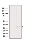 Anti-Aquaporin 6 antibody used in Western Blot (WB). GTX05047