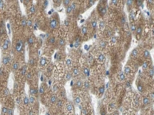 Anti-MMP11 antibody used in IHC (Paraffin sections) (IHC-P). GTX05076