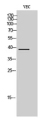 Anti-Casein Kinase 1 alpha (phospho Thr321) antibody used in Western Blot (WB). GTX05107