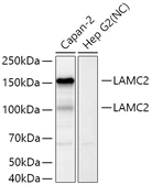Anti-Laminin gamma 2 antibody used in Western Blot (WB). GTX05125