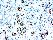 Anti-C4d antibody [C4D204] (ready-to-use) used in IHC (Paraffin sections) (IHC-P). GTX05137