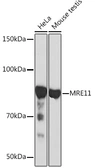 Anti-Mre11 antibody [ARC0931] used in Western Blot (WB). GTX05187