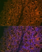 Anti-CEACAM6 antibody [ARC2110] used in IHC (Paraffin sections) (IHC-P). GTX05214