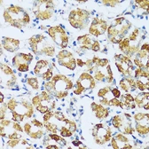 Anti-C1qC antibody used in IHC (Paraffin sections) (IHC-P). GTX05218
