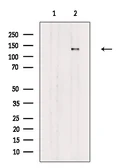 Anti-PER2 (phospho Ser662) antibody used in Western Blot (WB). GTX05221