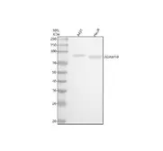 Anti-ADAM10 antibody [AAIC-1] used in Western Blot (WB). GTX05227