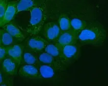Anti-Integrin alpha 3 antibody used in Immunocytochemistry/ Immunofluorescence (ICC/IF). GTX05230