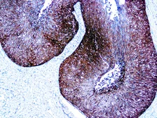 Anti-P16 antibody [JC2] (ready-to-use) used in IHC (Paraffin sections) (IHC-P). GTX05259