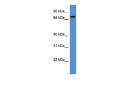 Anti-Angel1 Antibody used in Western Blot (WB). GTX05265