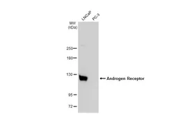 Anti-Androgen Receptor antibody [N1], N-term used in Western Blot (WB). GTX100056