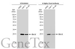 Anti-Bcl-2 antibody [N1N2], N-term used in Western Blot (WB). GTX100064