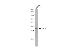 Anti-FHL1 antibody used in Western Blot (WB). GTX100266