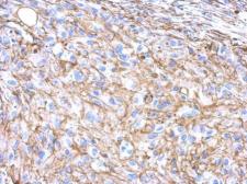 Anti-beta Actin antibody used in IHC (Paraffin sections) (IHC-P). GTX100313