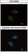 Anti-MMP9 antibody [N2C1], Internal used in Immunocytochemistry/ Immunofluorescence (ICC/IF). GTX100458