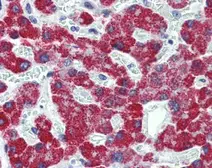 Anti-ACADS antibody used in IHC (Paraffin sections) (IHC-P). GTX100490