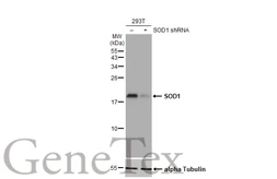 Anti-SOD1 antibody used in Western Blot (WB). GTX100554