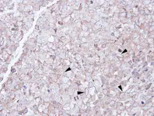 Anti-SCARA3 antibody [N2C2], Internal used in IHC (Paraffin sections) (IHC-P). GTX100595