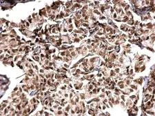 Anti-MTA1 antibody [C1C3] used in IHC (Paraffin sections) (IHC-P). GTX100610