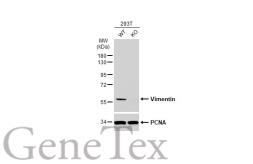 Anti-Vimentin antibody used in Western Blot (WB). GTX100619