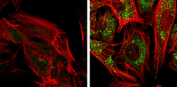 Anti-SQSTM1 / P62 antibody [N3C1], Internal used in Immunocytochemistry/ Immunofluorescence (ICC/IF). GTX100685