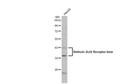 Anti-Retinoic Acid Receptor beta antibody used in Western Blot (WB). GTX100759