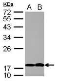 Anti-PTHLH antibody [N1C3] used in Western Blot (WB). GTX100762