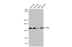 Anti-Ret antibody used in Western Blot (WB). GTX101059