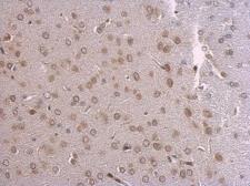 Anti-Lamin A + C antibody used in IHC (Paraffin sections) (IHC-P). GTX101126