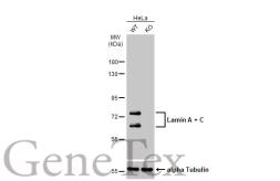 Anti-Lamin A + C antibody used in Western Blot (WB). GTX101127