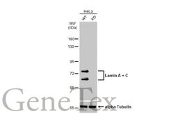 Anti-Lamin A + C antibody used in Western Blot (WB). GTX101127