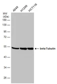 Anti-beta Tubulin antibody used in Western Blot (WB). GTX101279