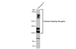 Anti-Calcium Sensing Receptor antibody used in Western Blot (WB). GTX101348
