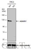 Anti-ADAM17 antibody [C2C3], C-term used in Western Blot (WB). GTX101358