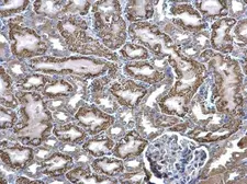 Anti-ACADM antibody used in IHC (Paraffin sections) (IHC-P). GTX101393