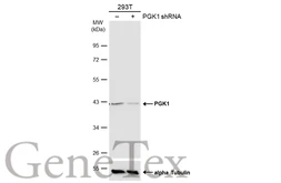 Anti-PGK1 antibody [N1C1] used in Western Blot (WB). GTX101405